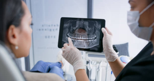 Licensed Teeth Whitening service in DuPont, WA - Smile Center Dentistry